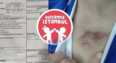 Eyüpsultan’da 3 Yaşındaki Çocuğa Şiddet ve İstismar İddiası; Valilik Soruşturma Başlattı!..