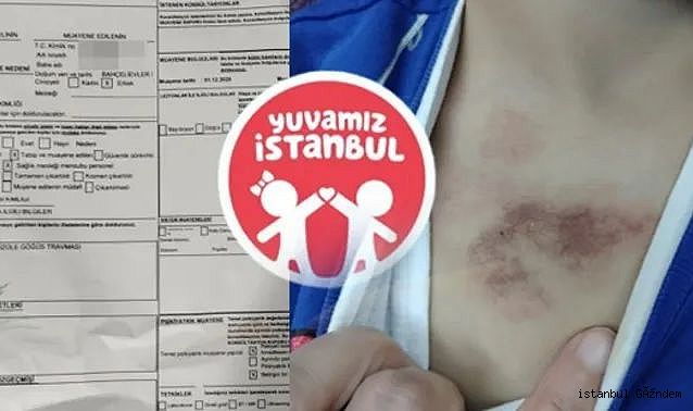 Eyüpsultan’da 3 Yaşındaki Çocuğa Şiddet ve İstismar İddiası; Valilik Soruşturma Başlattı!..